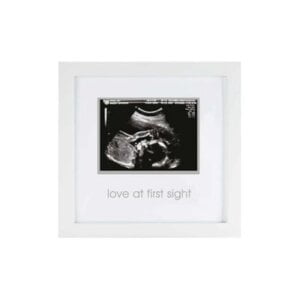 Love at First Sight Sonogram Picture Frame